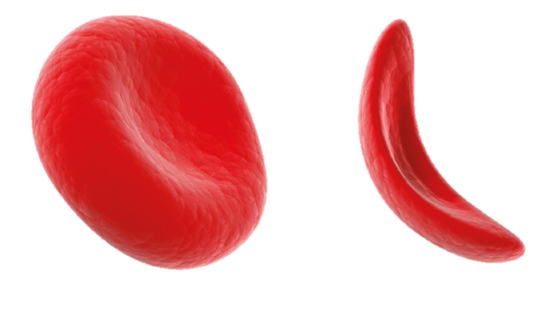 AI Legalese Decoder Revolutionizing Sickle Cell Disease Advocacy in the Instantly Interpret Free: Legalese Decoder - AI Lawyer Translate Legal docs to plain English