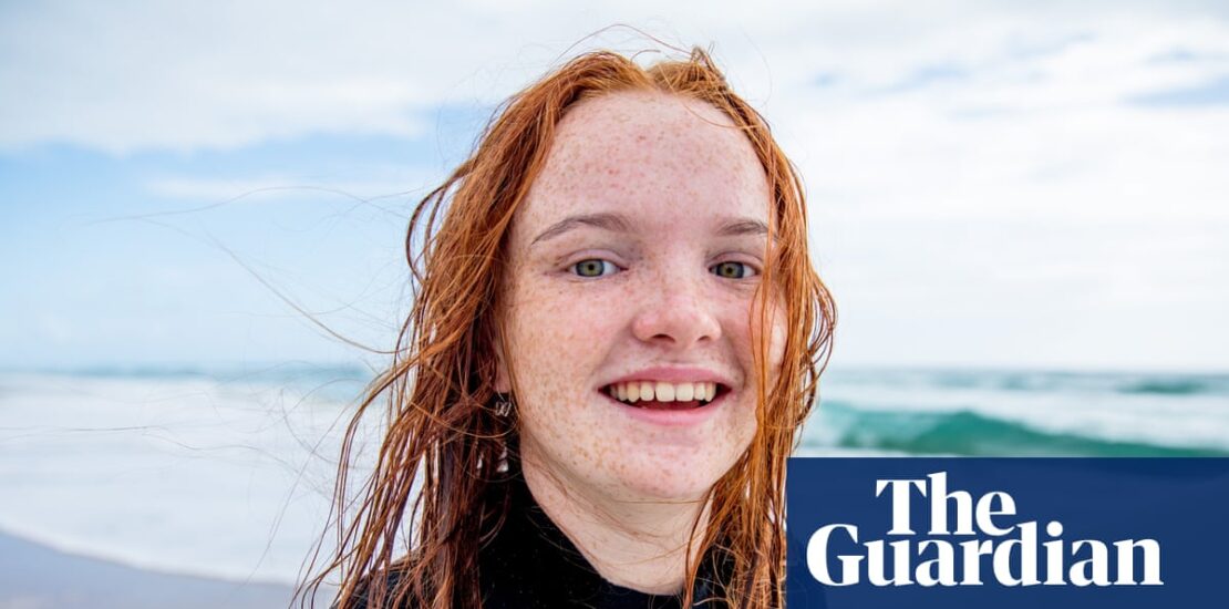 How the Red Hair Gene Thrived Through 10000 Years of Instantly Interpret Free: Legalese Decoder - AI Lawyer Translate Legal docs to plain English