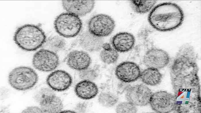 What You Should Know About the Rare Hantavirus in Jacksonville Instantly Interpret Free: Legalese Decoder - AI Lawyer Translate Legal docs to plain English