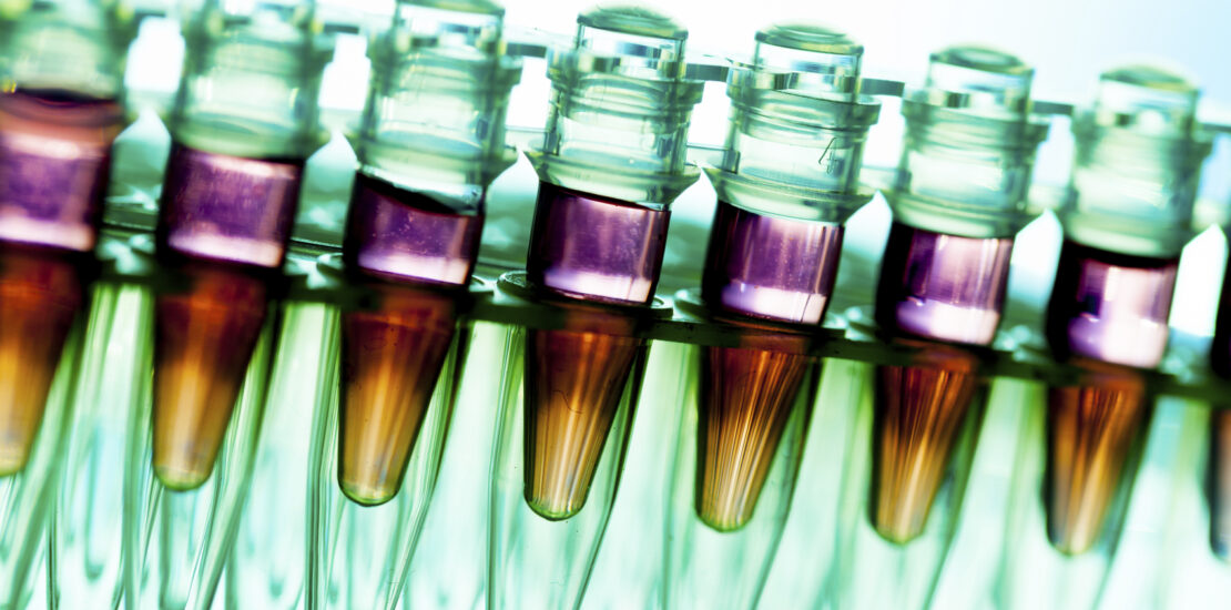 Asthma Drug Shows Promise in Treating Aggressive Cancers Instantly Interpret Free: Legalese Decoder - AI Lawyer Translate Legal docs to plain English