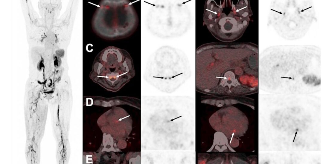 PET Scan Identified as SNMMIs Image of the Year for Instantly Interpret Free: Legalese Decoder - AI Lawyer Translate Legal docs to plain English
