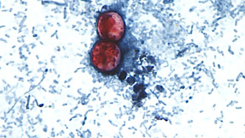 Parasite Contaminating Raw Produce Causes Illness Across States Instantly Interpret Free: Legalese Decoder - AI Lawyer Translate Legal docs to plain English