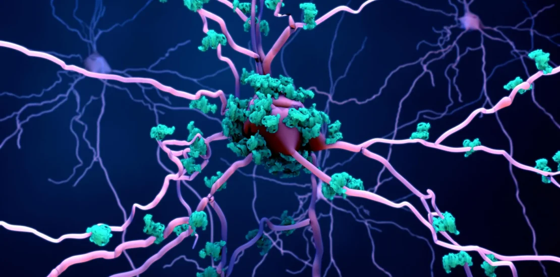 Scientists Discover How Alzheimers Disease Destroys Brain Cells Instantly Interpret Free: Legalese Decoder - AI Lawyer Translate Legal docs to plain English