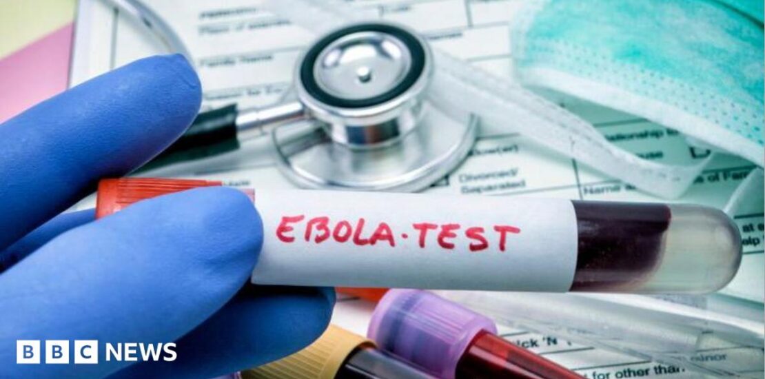 Understanding Ebola Current Cases and Risks in the UK Instantly Interpret Free: Legalese Decoder - AI Lawyer Translate Legal docs to plain English